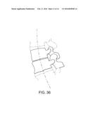 SPINAL INTERVERTEBRAL IMPLANT diagram and image