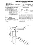 METHODS OF REPAIRING A JOINT USING A WEDGE-SHAPED IMPLANT diagram and image