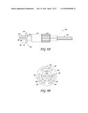 METHODS OF REPAIRING A JOINT USING A WEDGE-SHAPED IMPLANT diagram and image