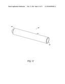 METHODS OF REPAIRING A JOINT USING A WEDGE-SHAPED IMPLANT diagram and image