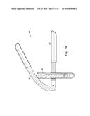 METHODS OF REPAIRING A JOINT USING A WEDGE-SHAPED IMPLANT diagram and image