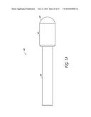 METHODS OF REPAIRING A JOINT USING A WEDGE-SHAPED IMPLANT diagram and image