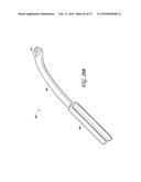 METHODS OF REPAIRING A JOINT USING A WEDGE-SHAPED IMPLANT diagram and image