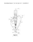 ENDOVASCULAR GRAFT HAVING A CANNULATION POCKET diagram and image