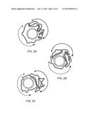 UNIFORM CRIMPING AND DEPLOYMENT METHODS FOR POLYMER SCAFFOLD diagram and image