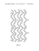 UNIFORM CRIMPING AND DEPLOYMENT METHODS FOR POLYMER SCAFFOLD diagram and image