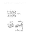 Patient Positioning Support Structure diagram and image