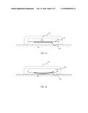 DEVICE AND METHOD FOR APPLICATION OF A TRANSDERMAL MEMBRANE diagram and image