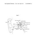 Controlled Release Auris Sensory Cell Modulator Compositions and Methods     for the Treatment of Otic Disorders diagram and image