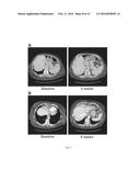 Targeted Therapies for Cancer diagram and image