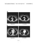 Targeted Therapies for Cancer diagram and image