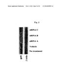 DRUG CARRIER AND DRUG CARRIER KIT FOR INHIBITING FIBROSIS diagram and image