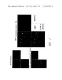 DRUG CARRIER AND DRUG CARRIER KIT FOR INHIBITING FIBROSIS diagram and image