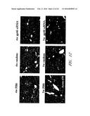 DRUG CARRIER AND DRUG CARRIER KIT FOR INHIBITING FIBROSIS diagram and image