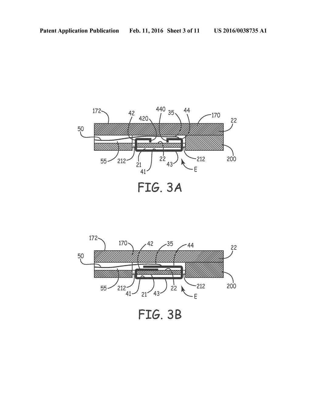 NOVEL FEATURES FOR ROUTING CONDUCTORS IN MEDICAL ELECTRICAL LEAD ELECTRODE     ASSEMBLIES - diagram, schematic, and image 04