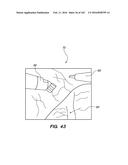 SYSTEM AND METHOD FOR OPTOGENETIC THERAPY diagram and image