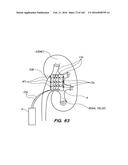 SYSTEM AND METHOD FOR OPTOGENETIC THERAPY diagram and image