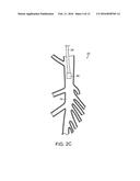 NEUROMODULATION AND ASSOCIATED SYSTEMS AND METHODS FOR THE MANAGEMENT OF     PAIN diagram and image