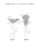 LACROSSE HEAD POCKET AND RELATED METHOD OF MANUFACTURE diagram and image