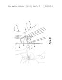 CORNER FLASHING SYSTEM diagram and image