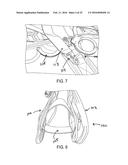 Assemblies for Personal Restraint diagram and image