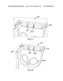 Assemblies for Personal Restraint diagram and image