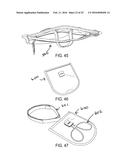 Assemblies for Personal Restraint diagram and image