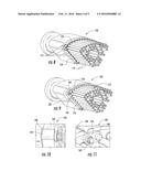 FUEL NOZZLE TUBE RETENTION diagram and image