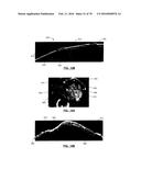 SYSTEM AND METHOD FOR WIDE FIELD OCT IMAGING diagram and image