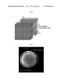 MAGNETIC RESONANCE IMAGING METHOD USING T2* MAPPING BASED ON ECHO PLANAR     IMAGING diagram and image