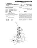 PREVENTION OF USE OF A CONTAMINATED MEDICAL PRODUCT diagram and image