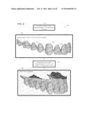 INTEGRATION OF INTRA-ORAL IMAGERY AND VOLUMETRIC IMAGERY diagram and image