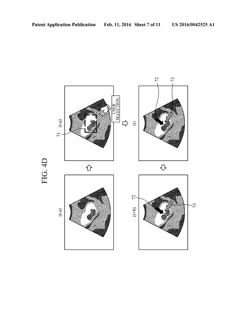 APPARATUS AND METHOD FOR VISUALIZATION OF REGION OF INTEREST - diagram, schematic, and image 08