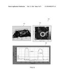 ORGANIC THIN FILM TRANSISTORS AND METHODS FOR THEIR MANUFACTURING AND USE diagram and image