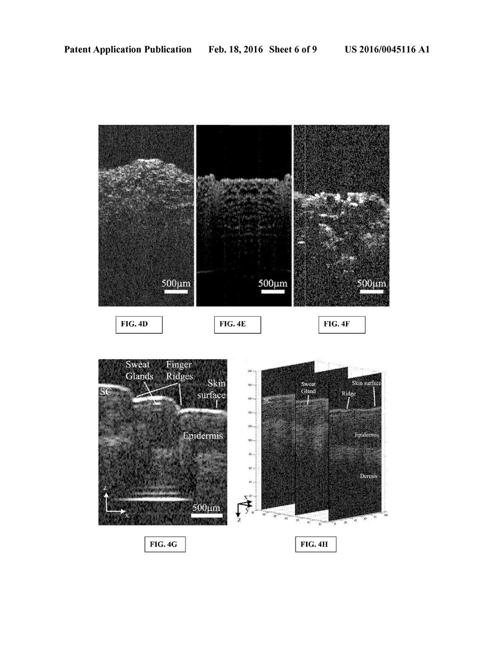 FORWARD-IMAGING OPTICAL COHERENCE TOMOGRAPHY (OCT) SYSTEMS AND PROBES - diagram, schematic, and image 07