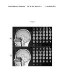 Brain Activity Measuring Apparatus and Brain Activity Measuring Method diagram and image