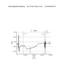 METHOD AND APPARATUS FOR DETECTING SEIZURES diagram and image