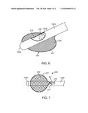 SURGICAL SYSTEM WITH EXPANDABLE SHIELD diagram and image