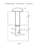 QUICK-RELEASE SYSTEMS FOR EXTRASKELETAL FIXATION diagram and image