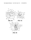 INTERSPINOUS VERTEBRAL STABILIZATION DEVICES diagram and image