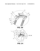 INTERSPINOUS VERTEBRAL STABILIZATION DEVICES diagram and image