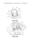 INTERSPINOUS VERTEBRAL STABILIZATION DEVICES diagram and image