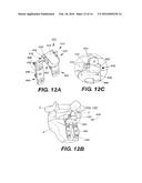 INTERSPINOUS VERTEBRAL STABILIZATION DEVICES diagram and image