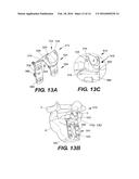 INTERSPINOUS VERTEBRAL STABILIZATION DEVICES diagram and image