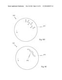 AN ENTRY GUIDE MANIPULATOR WITH A ROLL SYSTEM AND AN INSTRUMENT     MANIPULATOR POSITIONING SYSTEM diagram and image