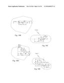 AN ENTRY GUIDE MANIPULATOR WITH A ROLL SYSTEM AND AN INSTRUMENT     MANIPULATOR POSITIONING SYSTEM diagram and image