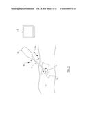 SURGICAL MECHANISM CONTROL SYSTEM diagram and image