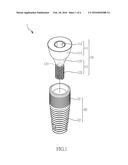 DENTAL IMPLANT PACKAGE diagram and image