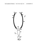 MALE URETHRAL PROSTHESIS WITH TENSIONING MEMBER diagram and image