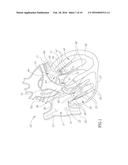 CARDIAC VALVE COMMISSURE BRACE diagram and image